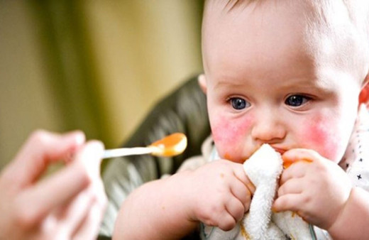 Alerjisi olan çocuk obeziteden korunmalı! Okul kantinleri iyi denetlenmeli...