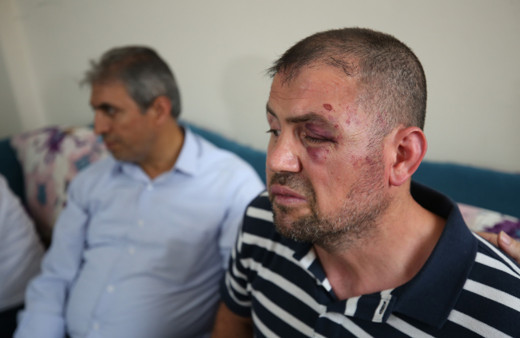 Bursa'da gazinin dövülmesine ilişkin davada 2 kişi tahliye edildi