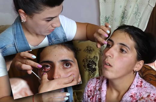 Doktorlar çare bulamadı gözünden yaş yerine kristal damlıyor