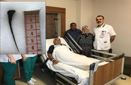 Karın ağrısı şikayetiyle hastaneye gitmişti! Doktorlar bile şaşırdı