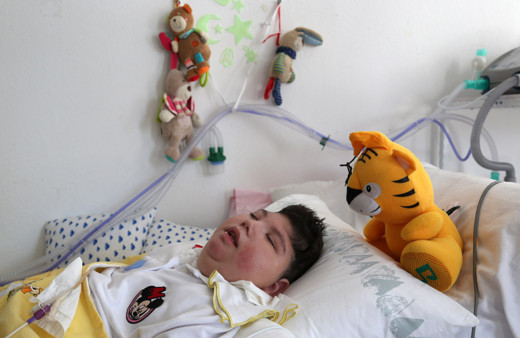 Nörolojik epilepsi hastası olarak dünyaya geldi! Annesi evini yoğun bakım odasına çevirdi