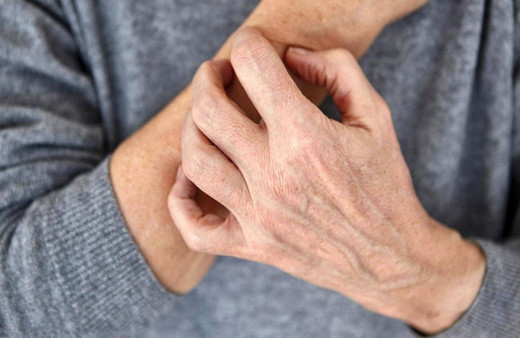 Prof. Dr. Nilgün Atakan: Her 4 kişiden birinde ürtiker hastalığı görülüyor