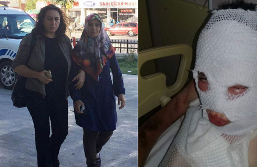 Komşularının üzerine kezzap dökmüştü! Cezası belli oldu