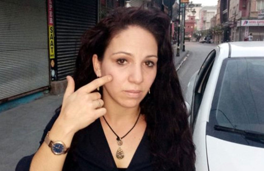 Terör sevicileri saldırdı o pes etmedi!