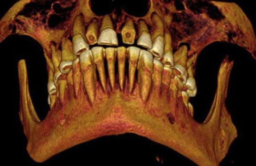 Eski Mısır'da kullanılan 1600 yıllık en eski diş macunu tarifini deneyin!