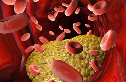 Kötü kolesterol nedir? Kolesterol değerleri yüksek-düşük ve normal kaç olur