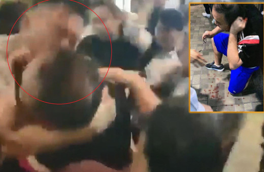 Hong Kong’da meclis üyesinin kulağı ısırılarak koparıldı