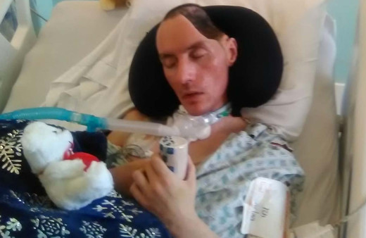 Beyzbol sopalı saldırı hayatını kararttı! Kafasının yarısı alındı