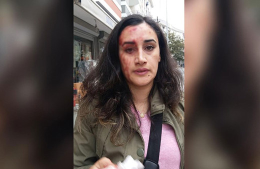 Ahlaksız patron! Tazminatsız işten attığı kadın işçinin başını taşla kırdı