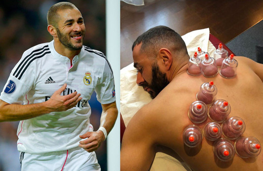 Karim Benzema hacamat yaptırdı “iyileşme” notunu düştü