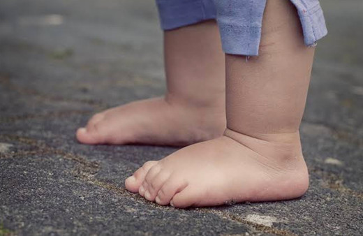 Çocuklarda en sık görülen ortopedik hastalıklar ve tedavi yolları