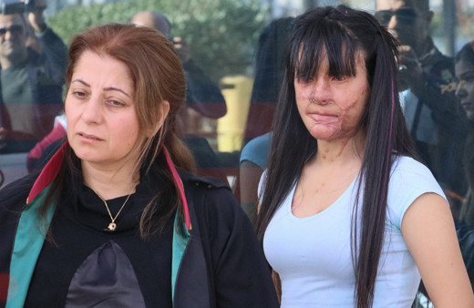 Yüzü asitle yakılan Berfin Özek ilk kez mahkemede