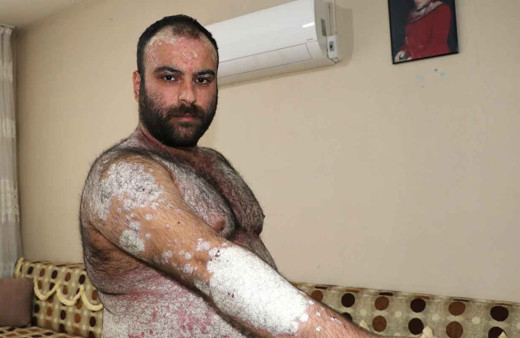 Kimse korkmasın diye dışarı çıkmıyor