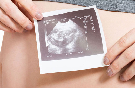 Bu nasıl kürtaj yasası! Kadınlara zorla görüntüleri izlettirecekler