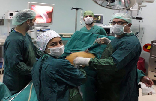 Çorum'da 4 kişinin safra kesesi taşlarını sayması 1 saat sürdü