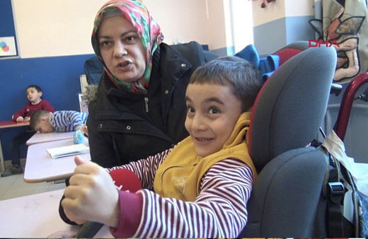 Serebral palsi hastası görüntüsü nasıl olur Serebral palsi belirtileri neler?