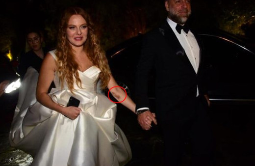 Dün akşam evlenen oyuncu Naz Elmas'ın kolundaki morluklar dikkat çekti!