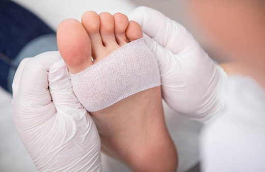 Diyabet ayak bakımı nasıl olmalı küçük kızarıklıklar bile hayati tehlike yaratabilir!