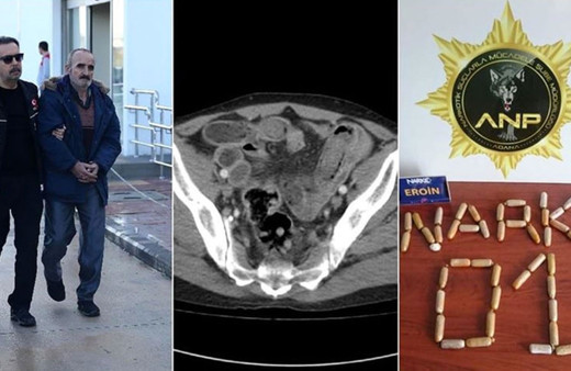 Yuttuğu 49 paket eroini 1 haftada çıkardı