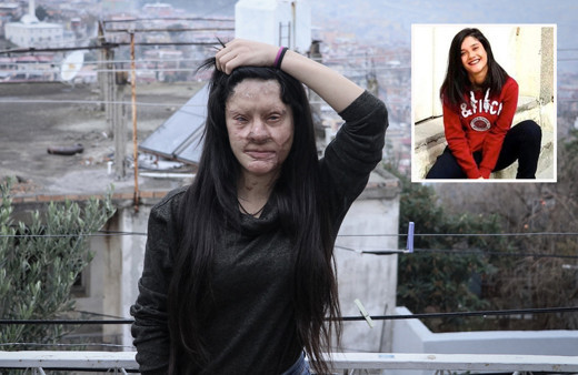 Asitle yüzü yakılan Berfin Özek'ten karar sonrası zor soru