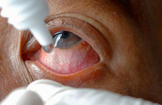 Göz damlasıyla kocasını öldürdü