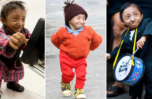 Dünyanın en kısa adamı 28 yaşında hayatını kaybetti