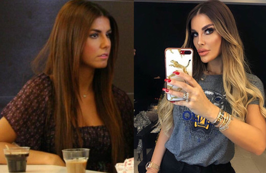 Adanalı dizisinin Pınar'ı Tuğçe Özbudak estetikle bambaşka biri oldu son hali olay