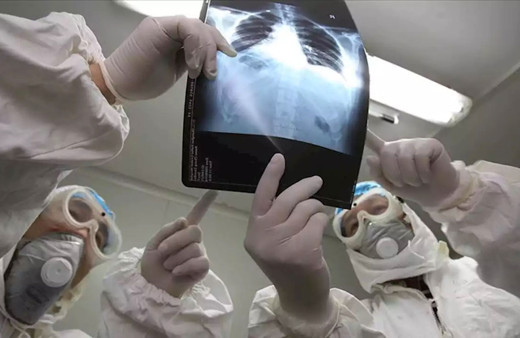 Koronavirüs için ilaç bulundu mu AIDS hastalığıyla ilgisi ne?