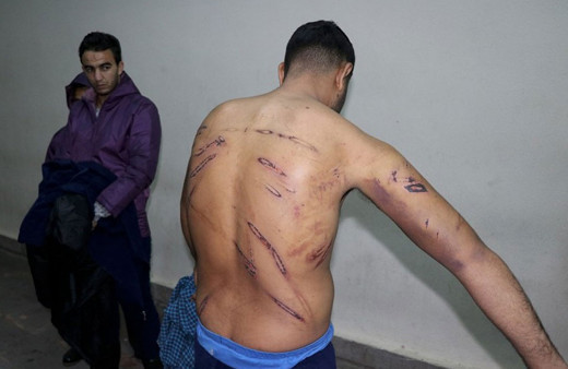 Yunanistan'da dünyayı utandıran görüntüler!