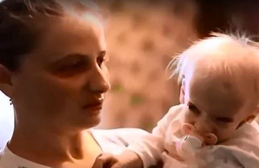 Çok nadir görünen hastalık! 8 yaşında yaşlılıktan öldü