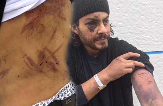 Mültecilere Yunan işkencesi askerler demir çubuklarla dövdü