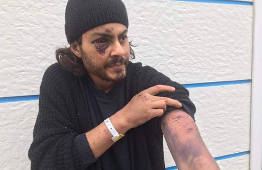 Yasa dışı yollarla Yunanistan'a kaçarken demir sopalarla dövülüp geri gönderildi