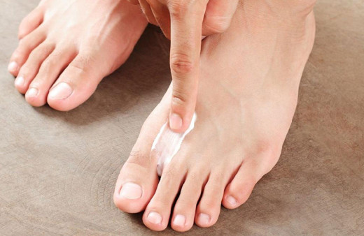 Tırnak batması nasıl geçer ayakkabı giymek bile sorun olabilir!