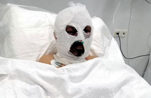 Öğrenci servisi şoförünü aracın içinde tiner döküp yaktı