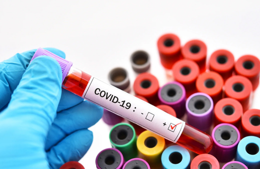 Covid-19'un geçmeyen etkisi tüm dünyayı sarstı! 1 milyon kişi koku duyusunu kaybetti