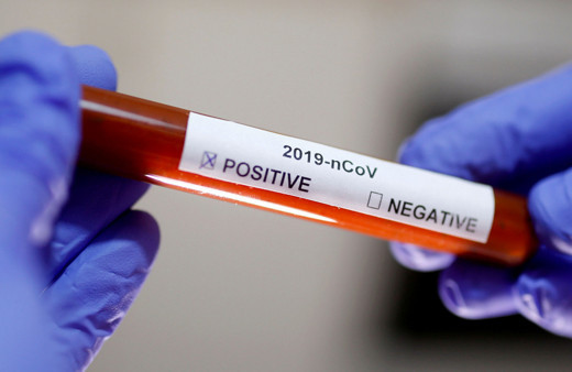 Sanayi ve Teknoloji Bakanlığı'ndan fabrikalara koronavirüs uyarısı