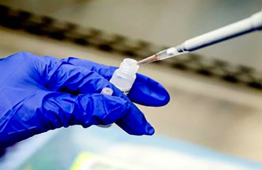 Türkiye’de bugüne kadar kaç kişiye koronavirüs testi yapıldı? Rakam belli oldu