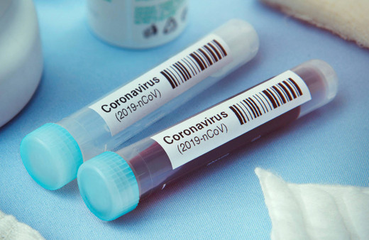 Koronavirüsle ilgili korkutan araştırma! Canlı kalabildiği alanlara bakın