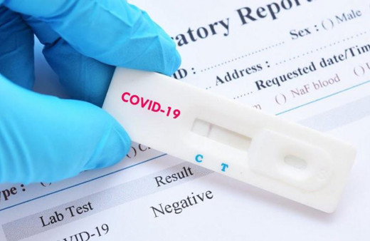 Çinli yetkililerden test kiti açıklaması! Sorun bizde değil sizde