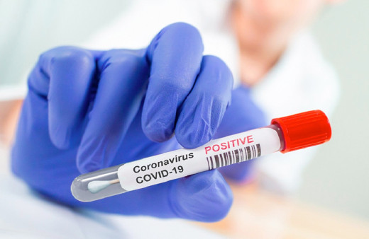 İllere göre koronavirüs vaka sayısı 2 Nisan koronavirüs olan iller listesi