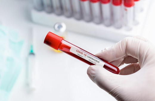 Ankara coronavirüs vaka sayısı kaç? Kırıkkale, Aksaray, Nevşehir ve Yozgat da var