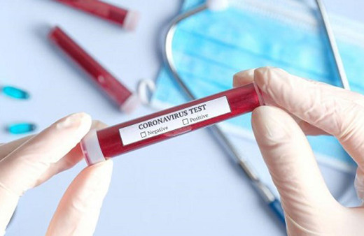 Koronavirüs Bilim Kurulu yeni tip koronavirüs (Kovid-19) rehberini güncelledi