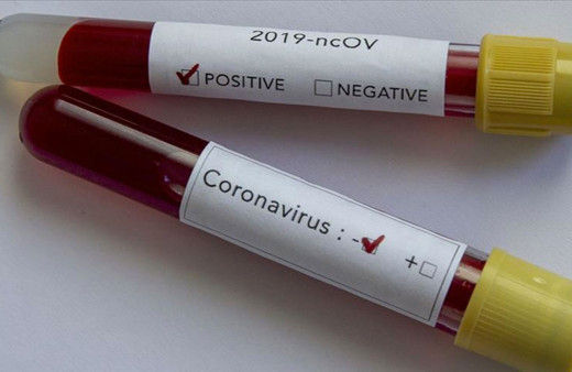 Koronavirüsün akciğerden başka bir organı daha etkilediği ortaya çıktı