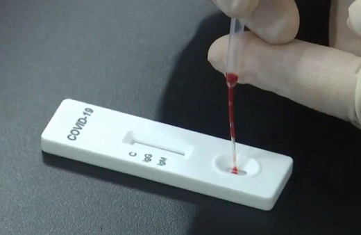 Şok gelişme! İngiltere'nin Çin'den ithal ettiği tanı kitlerinde koronavirüs tespit edildi