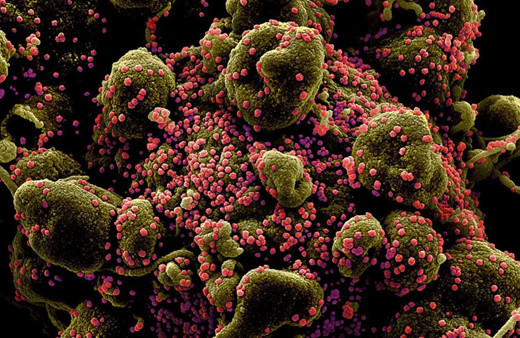 Koronavirüsün insan hücrelerinde yayılışı görüntülendi! Bu ne hız böyle