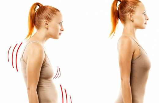 Dik duruş için bunları yapın kamburluğu önlüyor!