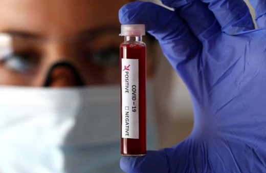 Koronavirüsü durduran ilaç bulundu! ABD'de çalışan Türk doktor Derya Unutmaz duyurdu