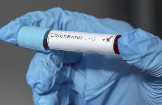 Edirne'de 69 yaşındaki eczacı koronavirüsten hayatını kaybetti bu ikinci ölüm oldu