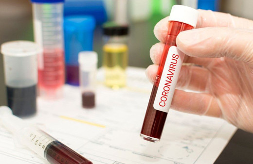 İstanbul Tıp Fakültesi'nde antikor testi yapılmaya başlandı