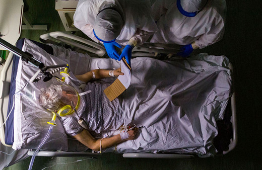 Koronavirüs böbrekleri iflas ettiriyor! Covid-19 tedavisi görenlerde böbrek yetmezliği başladı